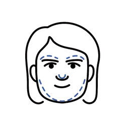 Facial Feminization Surgery