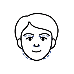 Facial Masculinization Surgery