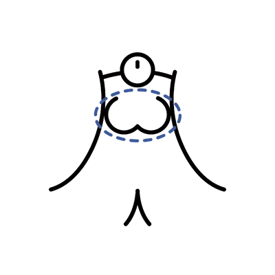 Orchiectomy in Thailand: Cost, Top Surgeons & Hospitals