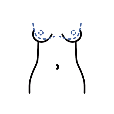 Periareolar Top Surgery in Thailand: Cost, Top Surgeons & Hospitals