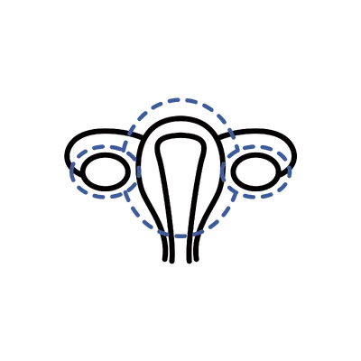 Hysterectomy & Oophorectomy