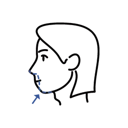 Jaw & Chin Contouring