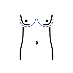 MTF Breast Augmentation