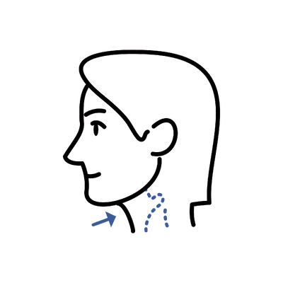 Voice Feminization Surgery